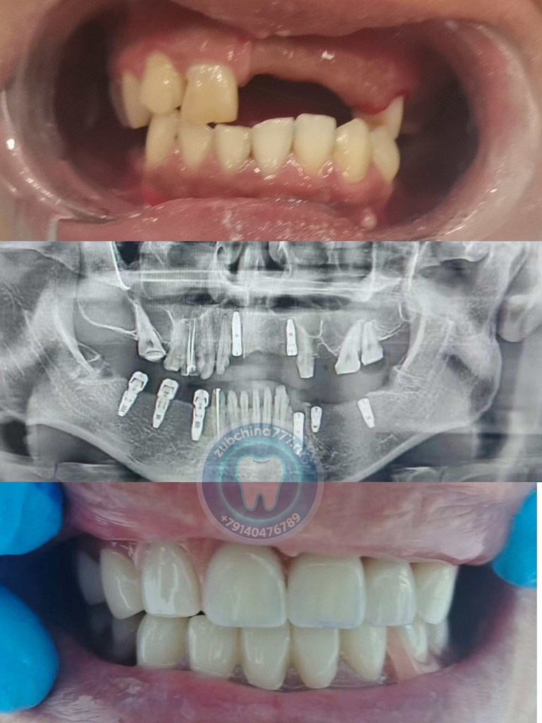 微信图片_20250813141727_252