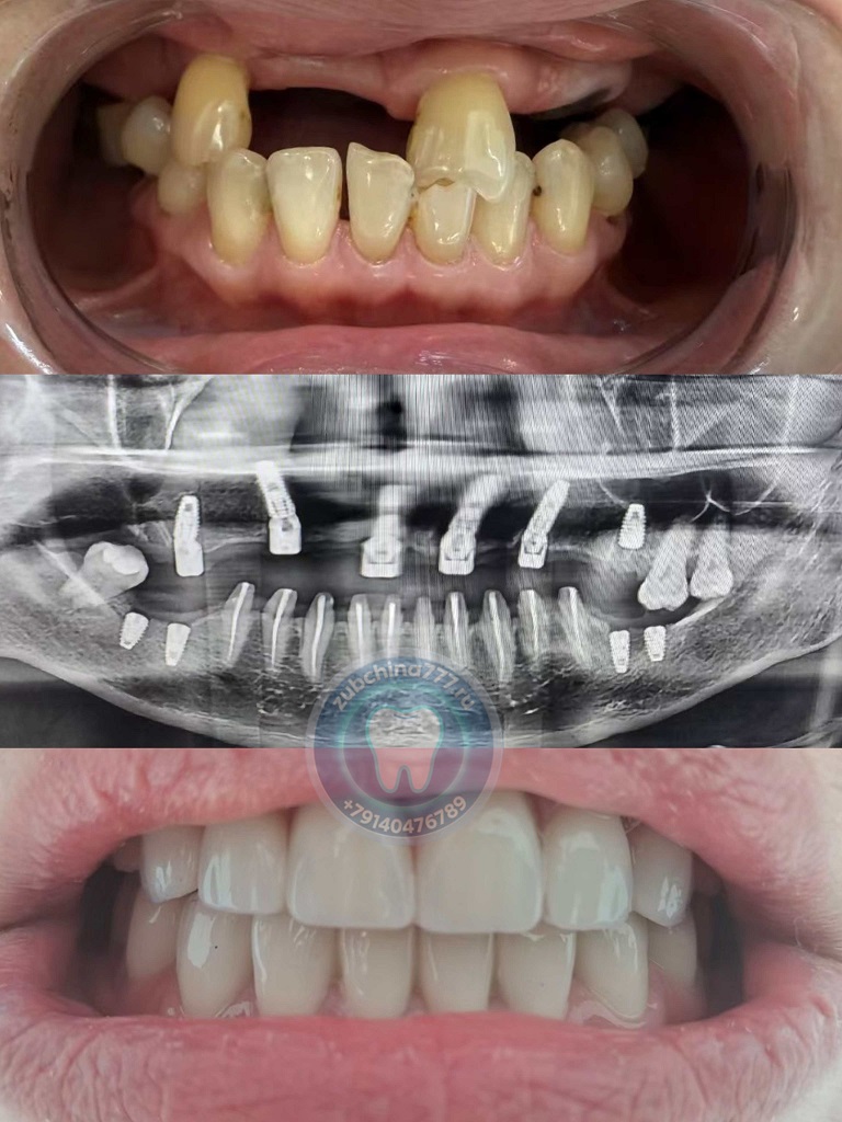 微信图片_20250813141727_255